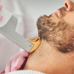 How cosmetic mole removal enhances your confidence